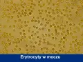 Mikroskopowy obraz erytrocytów w moczu psa. Widoczne liczne, okrągłe komórki, niektóre o postrzępionych brzegach, co może wskazywać na normę.