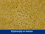 Mikroskopowy obraz erytrocytów w moczu psa. Widoczne liczne, okrągłe komórki, niektóre o postrzępionych brzegach, co może wskazywać na normę.
